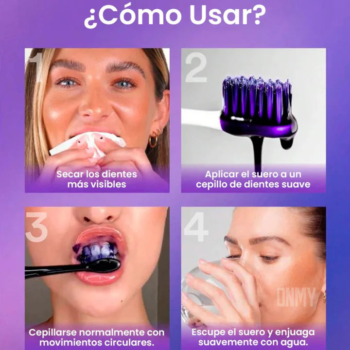 SmileKit® Blanqueador Dental: ¡Blanquea tus Dientes en 30 SEGUNDOS!